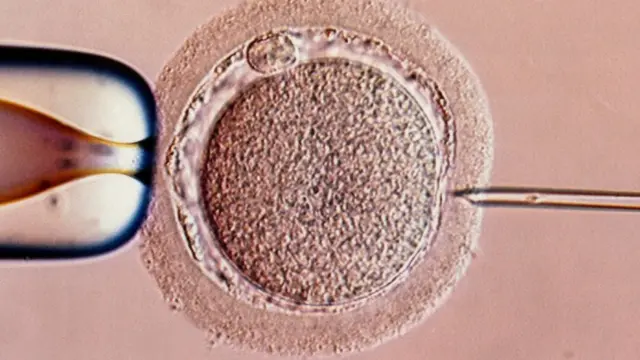 IVF teknolojisi