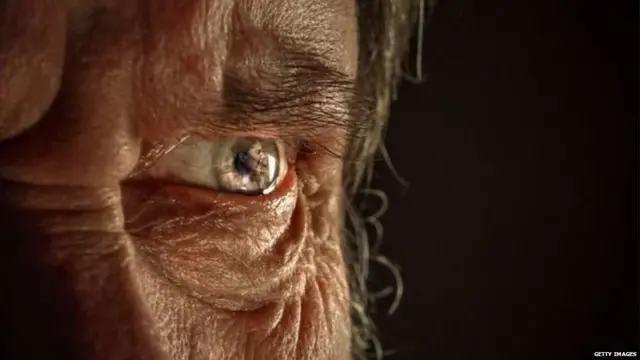 माणसाचा डोळा