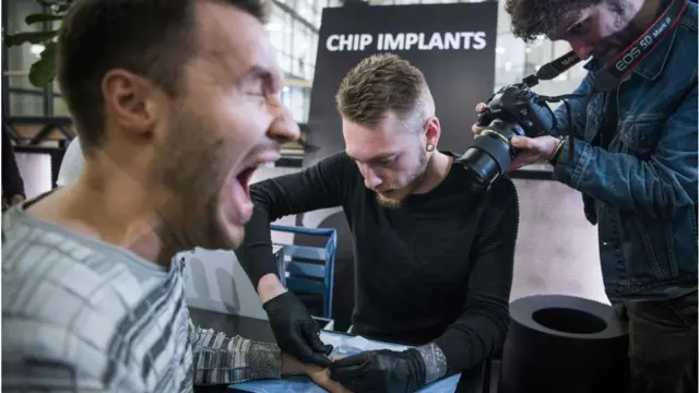 শরীরের মাইক্রোচিপ নেয়া সুইডিশদের মধ্যে জনপ্রিয় হয়ে উঠেছে