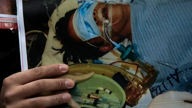 资料图片：刘进图被袭的报道