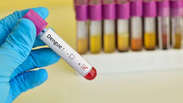 Dengue fever in Sri Lanka