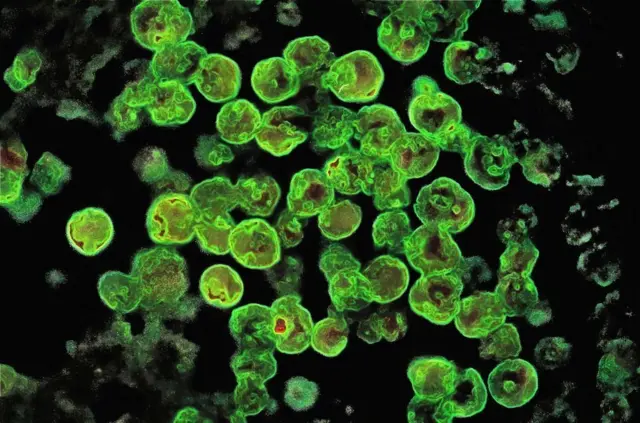 амеба naegleria fowleri улази у људско тело преко носа