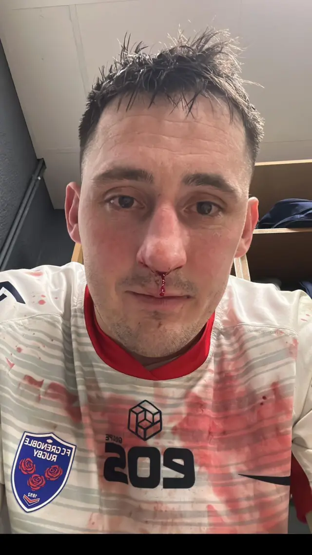 Sam Davies in a bloodied Grenoble rugby jersey 
