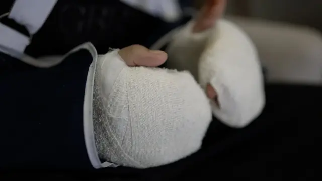 Muhamedove ruke u gipsu