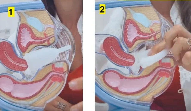 Illustration montrant comment insérer la coupe menstruelle