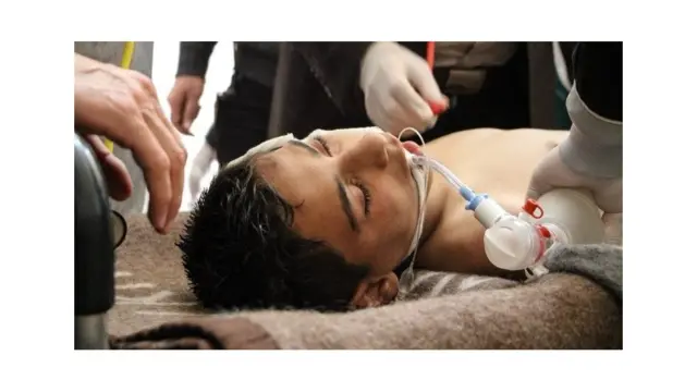 A Syrian victim receives treatment after an alleged chemical attack at a field hospital in Saraqib