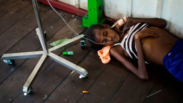 Penyakit campak sempat mewabah di Papua tahun lalu, menyebabkan ratusan orang meninggal