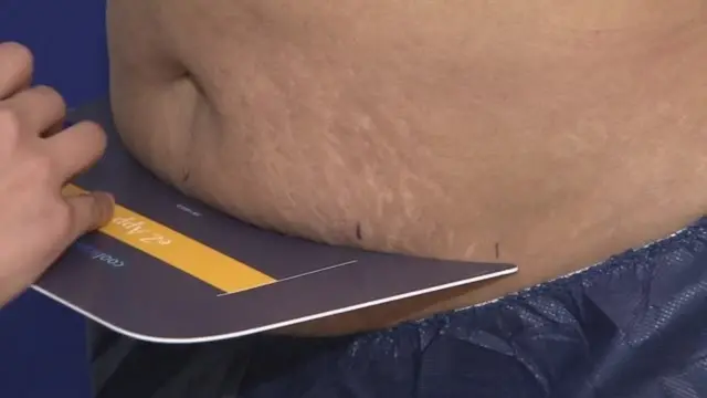 Hatahivyo, kikundi kidogo sana cha watu - hasa wanaume - wamepata athari mbaya baada ya kupata matibabu haya.