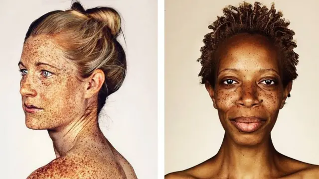 கரும்புள்ளிகள்