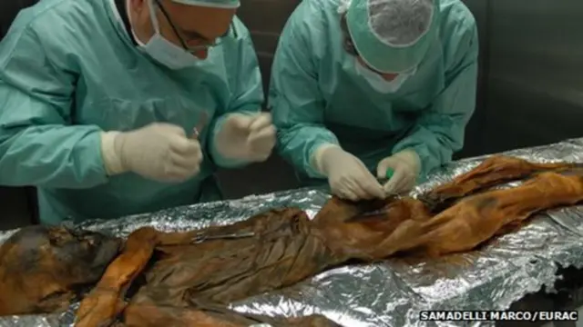 ओएट्ज़ी केस