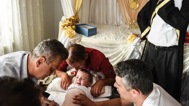 Trên thế giới, việc cắt bao quy đầu ở các bé trai thường được thực hiện do quy định tôn giáo hoặc vì lý do sức khỏe