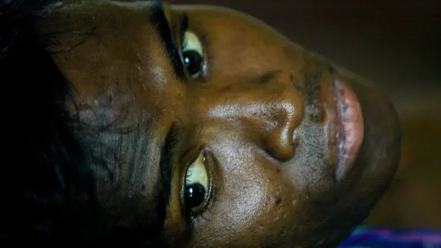 Onye anya ya na-acha edo edo