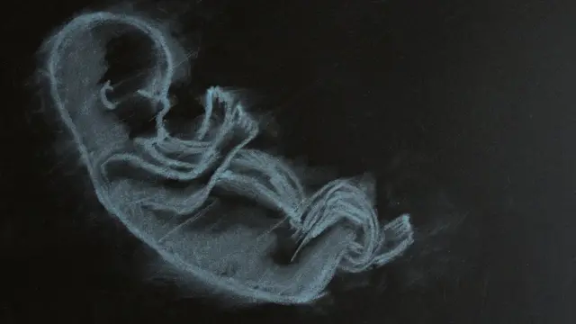 Un feto dibujado en un pizarrón