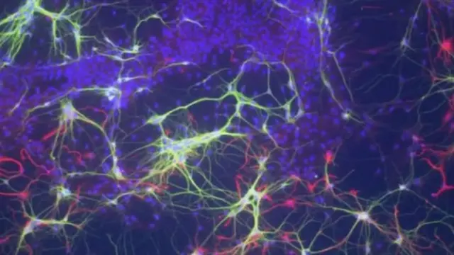 คลื่นความโน้มถ่วง, ฟิสิกส์ เวิลด์, Physics World, Gravitational waves, 10 เรื่องสุดยอด, การค้นพบทางฟิสิกส์, 2559, 2016, แมวของชโรดิงเจอร์, พร็อกซิมา บี, เมโซเลนส์