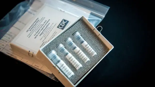 Ibikoresho byo gupima coronavirus by'ikigo cy'Amerika cyo kurwanya no kwirinda indwara (CDC, mu magambo ahinnye y'Icyongereza)