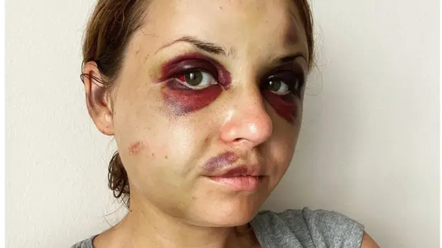 Після жорстокого нападу на Анастасію Лугову сотні жінок діляться історіями про пережите у потягах.