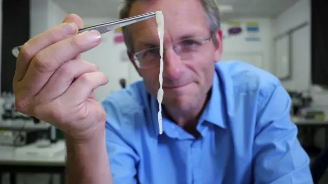 El doctor Mosley con una tenia adulta