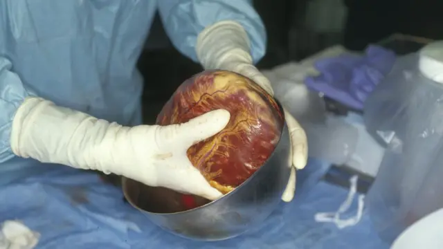 Кожен день дев'ять українців помирають, не дочекавшись трансплантації, каже Ірина Заславець з іDonor