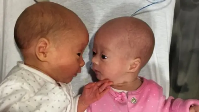 جسيكا وجورجيا