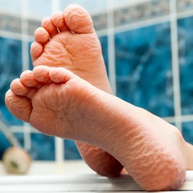 گیلی انگلیوں پر نمودار ہونے والی جھریاں