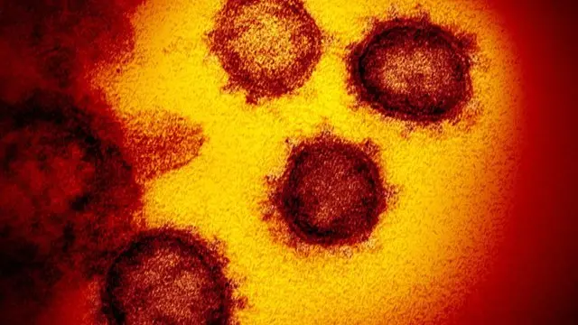 Coronavirus.
