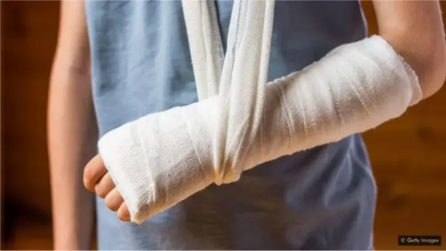 हात फ्रॅक्चर