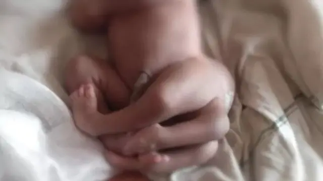 शारीरिक व्यंग