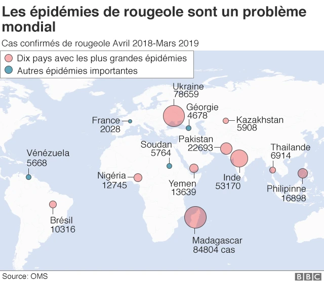 La rougeole est de retour dans le monde.