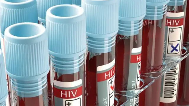 ஹெச்ஐவி வைரஸ் மாதிரிகள்