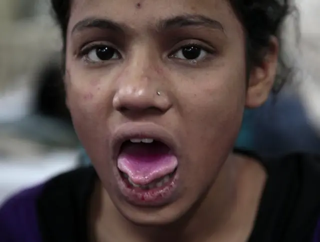 అలర్జీ సోకిన మహిళ