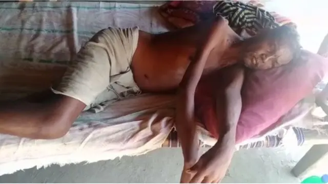 గోదావరి మన్యంలో కాళ్లవాపు కలకలం