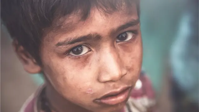 ગુજરાત સરકાર દ્વારા કોરોનામાં માતાપિતા બંનેને ગુમાવનાર બાળકને માસિક ચાર હજાર રૂપિયા આપવામાં આવશે