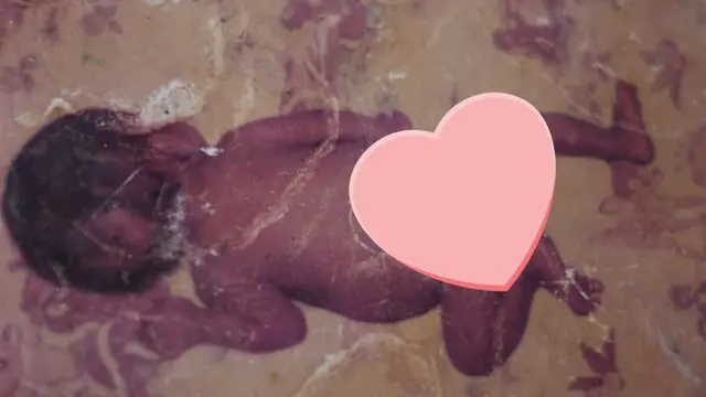 Pahan Ranaweera: Raising a girl with Down Syndrome in Sri Lanka