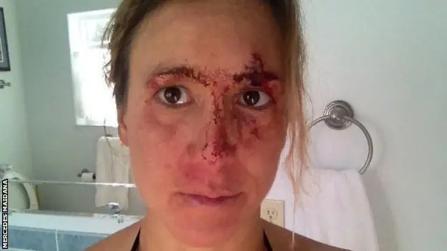 Mercedes Maidana covered in blood after her accident
