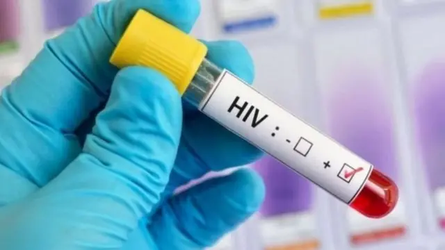หลอดตรวจเลือดเอชไอวี