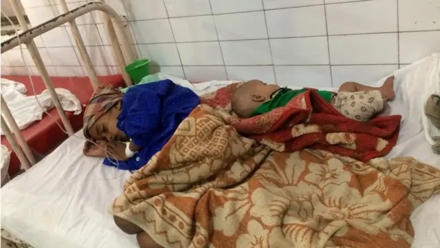 बहराइच अस्पताल जहां बच्चों की मौत हुई, उत्तर प्रदेश, योगी आदित्यनाथ