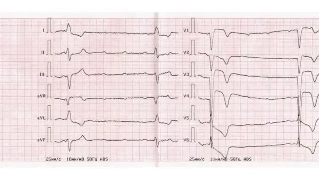 सांकेतिक तस्वीर