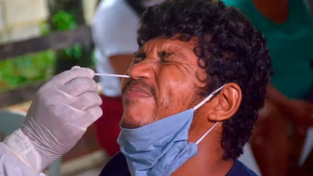 Prueba de coronavirus en Brasil.