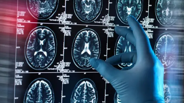 ભૂલી જવું