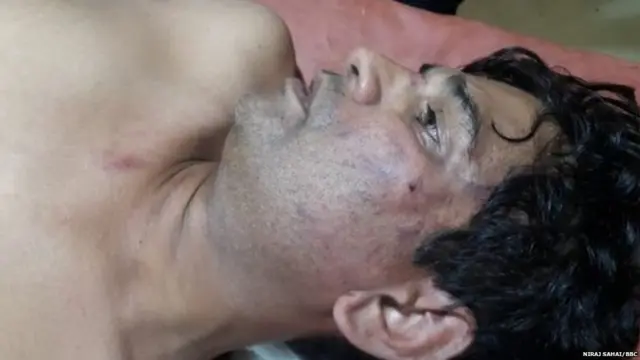 घायल अवस्था में संजय कुमार