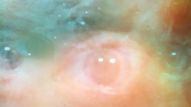 Сможем ли мы найти способ скорректировать это искаженное восприятие угрозы и избавиться от тревоги?