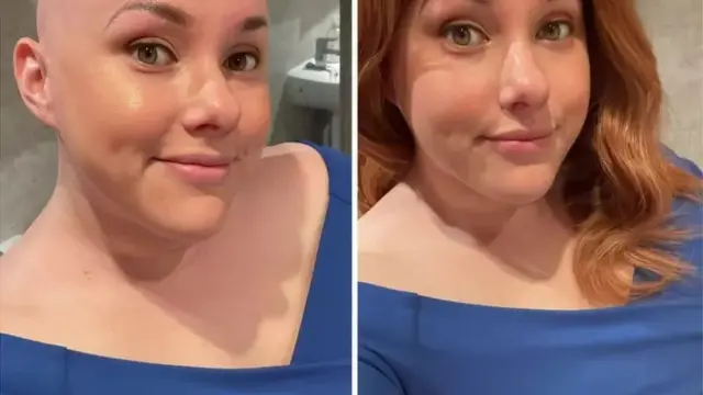 Laura a toujours du mal à aller travailler sans perruque.