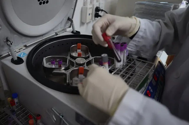 วันเอดส์โลก, โรคเอดส์, เอชไอวี, ยาต้านไวรัส, ผู้ติดเชื้อ