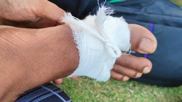 पदयात्रा कर रहे छात्रों के पैरों में छाले पड़ गए हैं