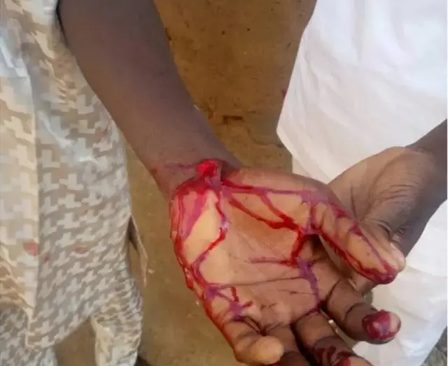 Wani da aka ji wa rauni a Kano