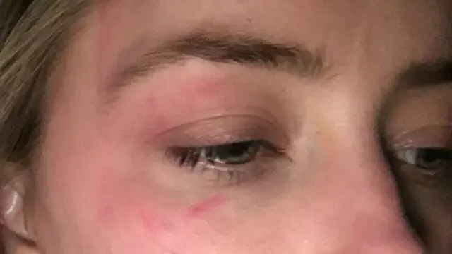 Amber Heard en una fotografía de su testimonio