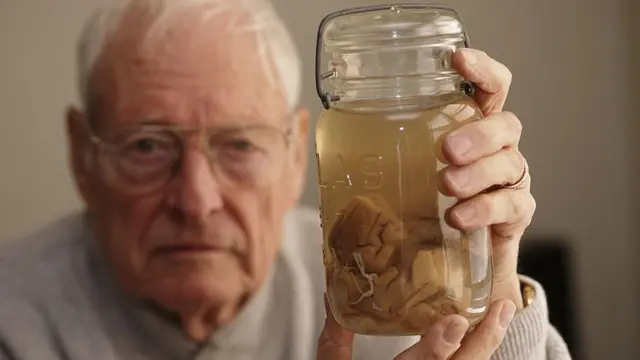 Thomas Harvey com o cérebroplataforma cbetEinsteinplataforma cbetum frasco