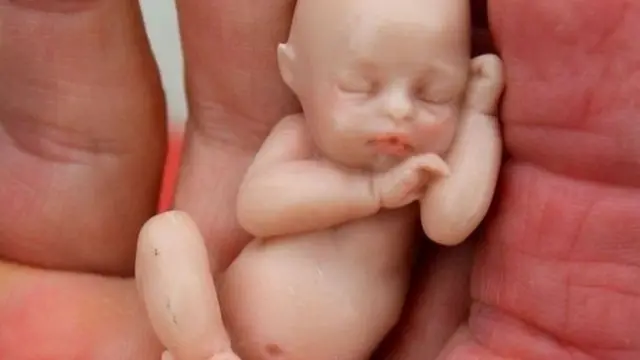 கருக்கலைப்பு abortion