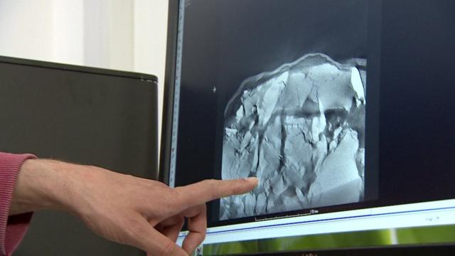 Closescomo fazer aposta da mega onlineimagens escaneadas do crânio