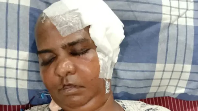 அரிய நோய்